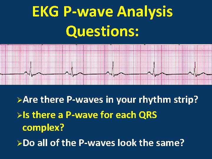 EKG P-wave Analysis Questions: ØAre there P-waves in your rhythm strip? ØIs there a
