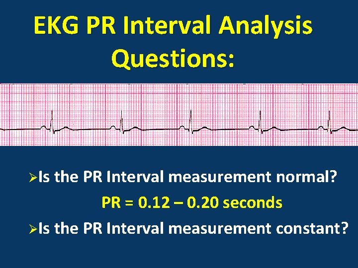 EKG PR Interval Analysis Questions: ØIs the PR Interval measurement normal? PR = 0.