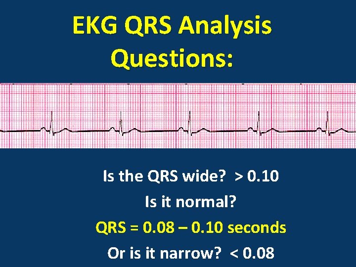 EKG QRS Analysis Questions: Is the QRS wide? > 0. 10 Is it normal?