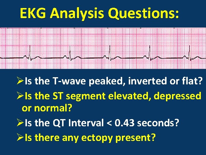 EKG Analysis Questions: ØIs the T-wave peaked, inverted or flat? ØIs the ST segment