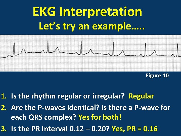 EKG Interpretation Let’s try an example…. . Figure 10 1. Is the rhythm regular