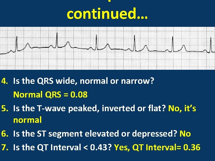 continued… 4. Is the QRS wide, normal or narrow? Normal QRS = 0. 08