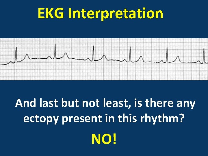 EKG Interpretation And last but not least, is there any ectopy present in this