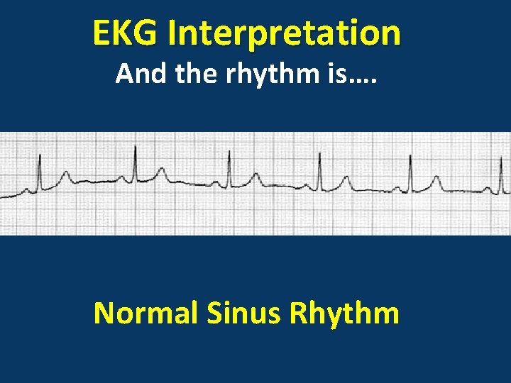 EKG Interpretation And the rhythm is…. Normal Sinus Rhythm 