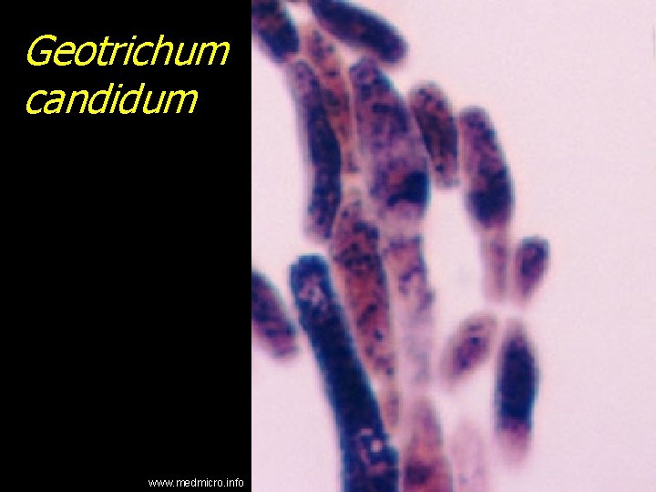 Geotrichum candidum www. medmicro. info 