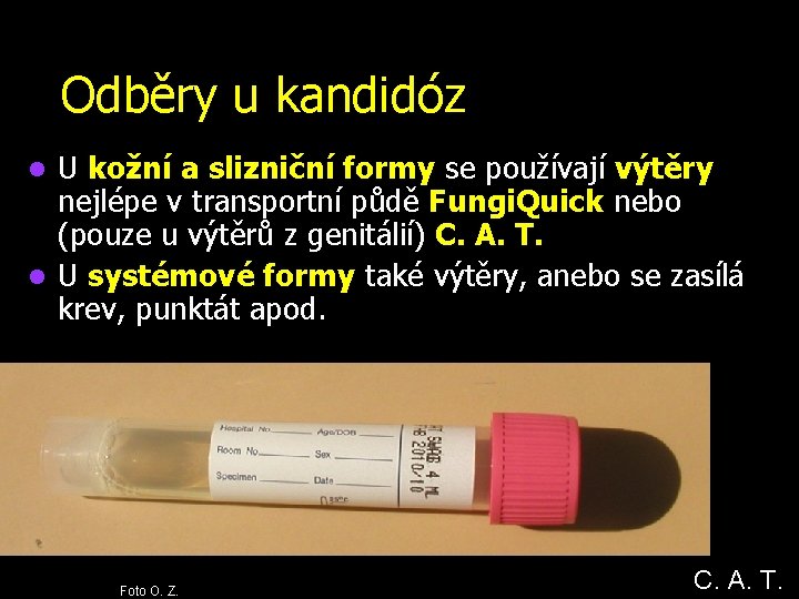 Odběry u kandidóz U kožní a slizniční formy se používají výtěry nejlépe v transportní