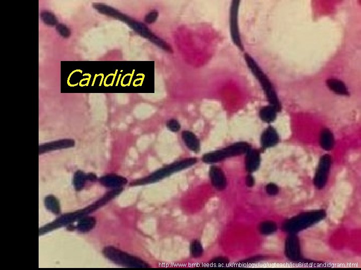 Candida http: //www. bmb. leeds. ac. uk/mbiology/ug/ugteach/icu 8/std/candidgram. html 