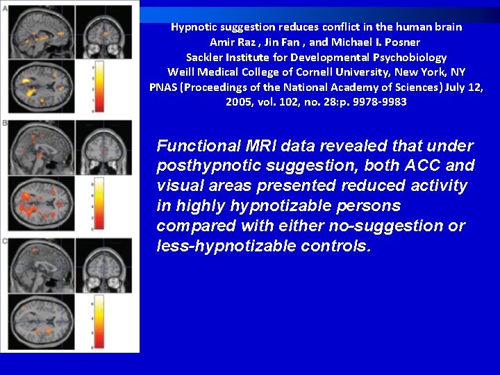 Hypnotic suggestion reduces conflict in the human brain Amir Raz , Jin Fan ,