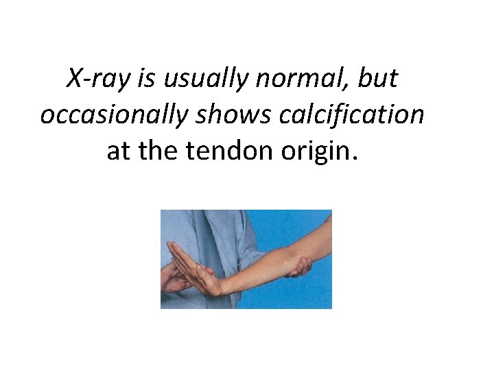 X-ray is usually normal, but occasionally shows calcification at the tendon origin. 