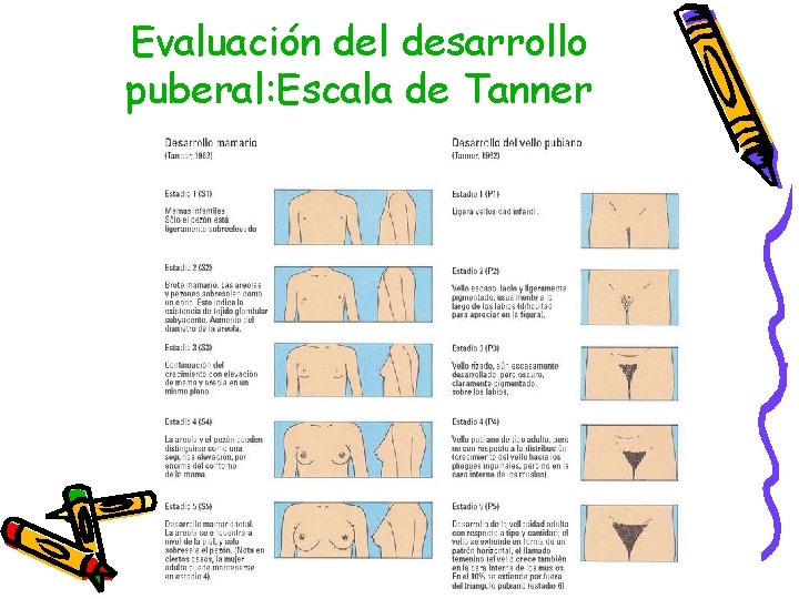 Evaluación del desarrollo puberal: Escala de Tanner 