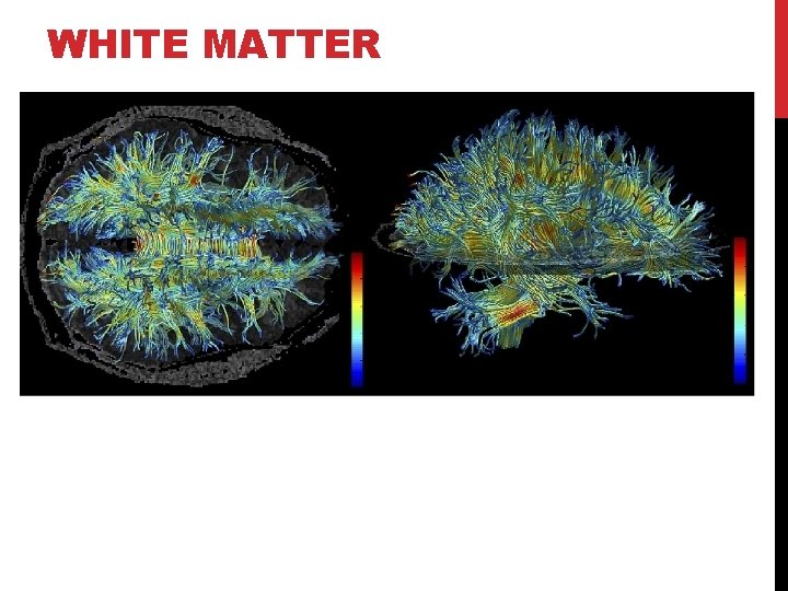 WHITE MATTER 