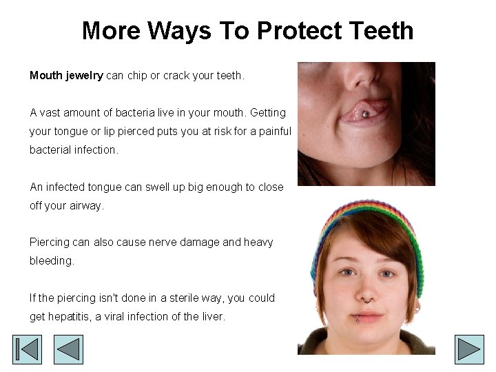 More Ways To Protect Teeth Mouth jewelry can chip or crack your teeth. A