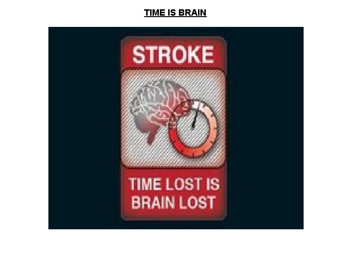 TIME IS BRAIN 
