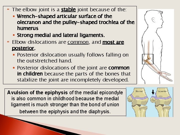  The elbow joint is a stable joint because of the: § Wrench-shaped articular
