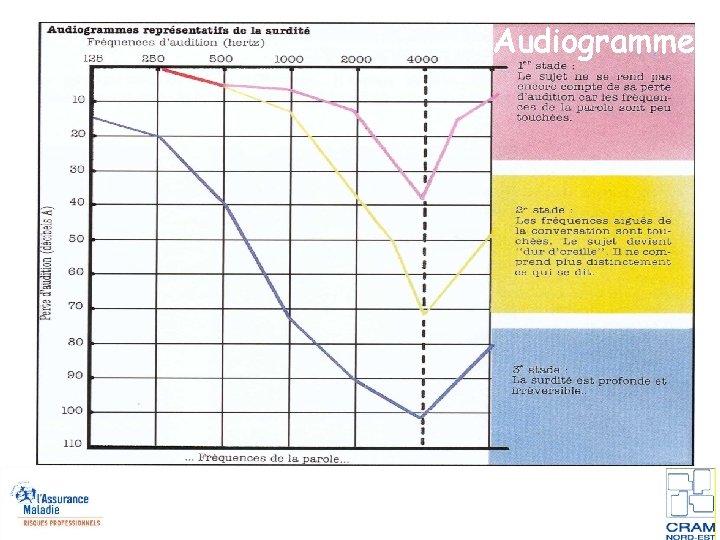 Audiogramme 