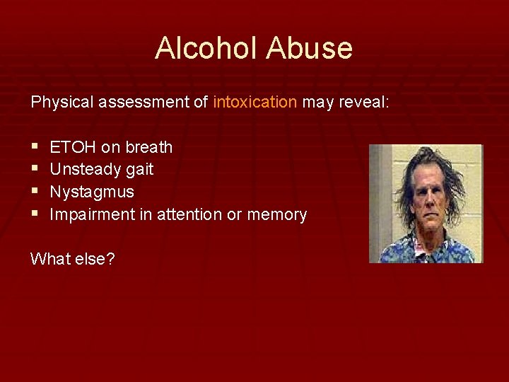 Alcohol Abuse Physical assessment of intoxication may reveal: § § ETOH on breath Unsteady