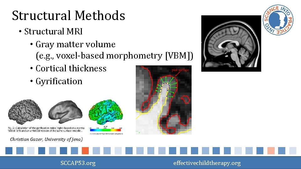 Structural Methods • Structural MRI • Gray matter volume (e. g. , voxel-based morphometry