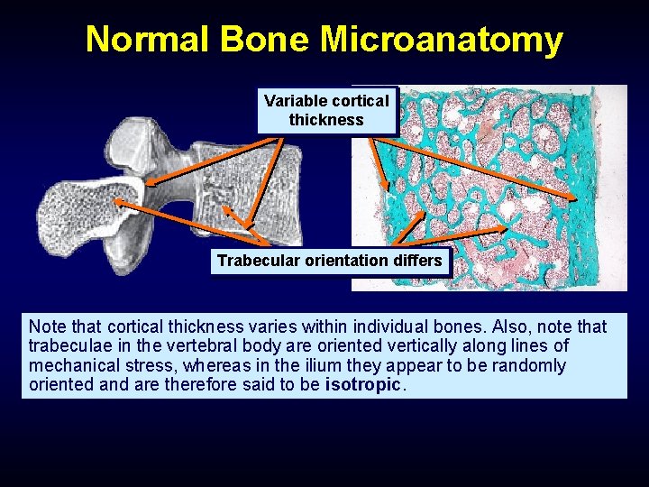 Normal Bone Microanatomy Variable cortical thickness Trabecular orientation differs Note that cortical thickness varies