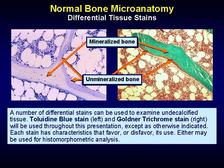 Normal Bone Microanatomy Differential Tissue Stains Mineralized bone Unmineralized bone A number of differential