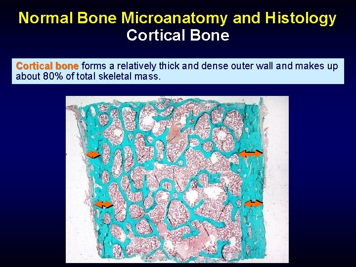 Normal Bone Microanatomy and Histology Cortical Bone Cortical bone forms a relatively thick and