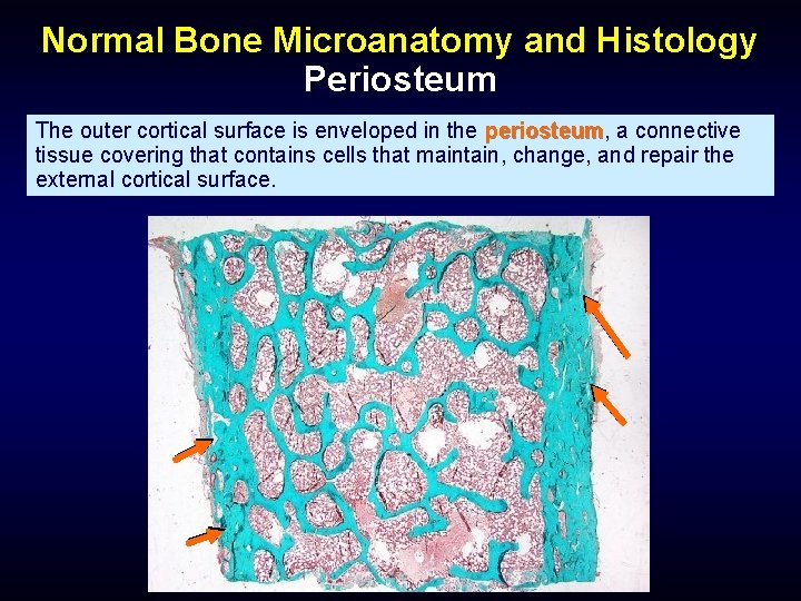 Normal Bone Microanatomy and Histology Periosteum The outer cortical surface is enveloped in the