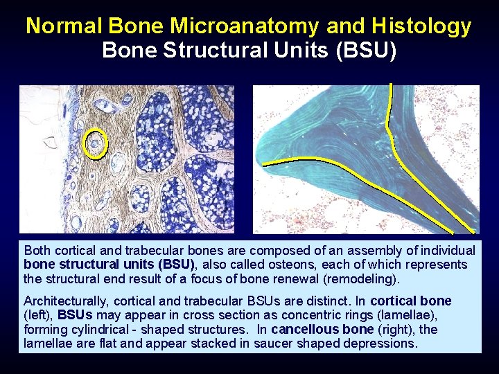 Normal Bone Microanatomy and Histology Bone Structural Units (BSU) Both cortical and trabecular bones