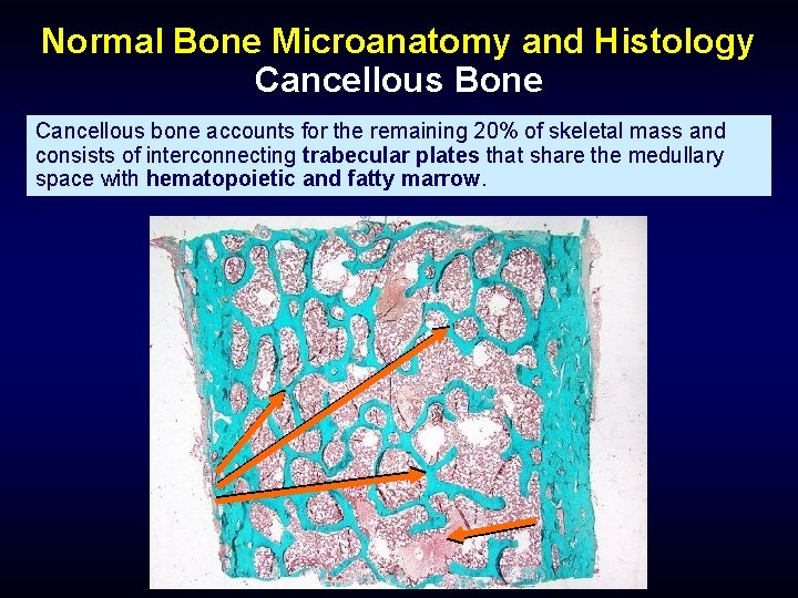 Normal Bone Microanatomy and Histology Cancellous Bone Cancellous bone accounts for the remaining 20%