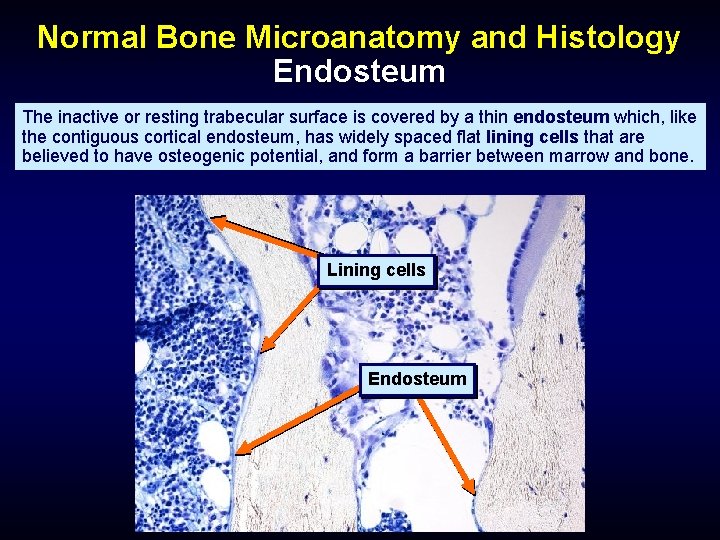 Normal Bone Microanatomy and Histology Endosteum The inactive or resting trabecular surface is covered