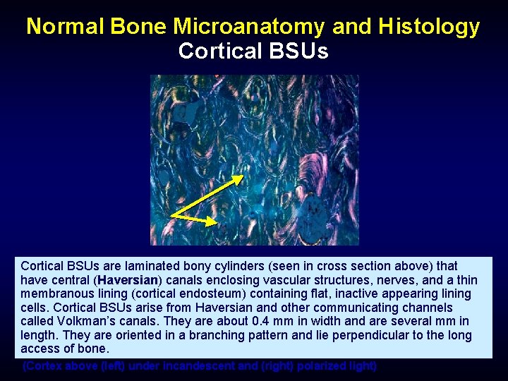 Normal Bone Microanatomy and Histology Cortical BSUs are laminated bony cylinders (seen in cross