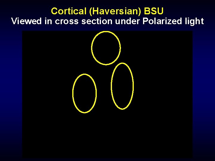 Cortical (Haversian) BSU Viewed in cross section under Polarized light 