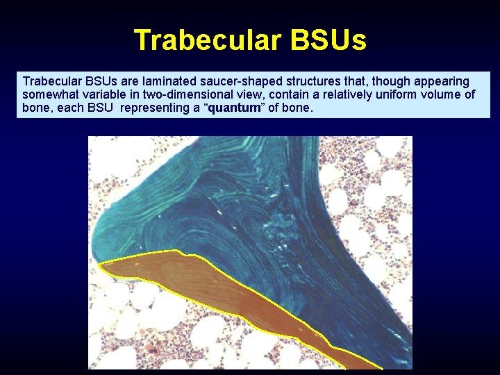 Trabecular BSUs are laminated saucer-shaped structures that, though appearing somewhat variable in two-dimensional view,