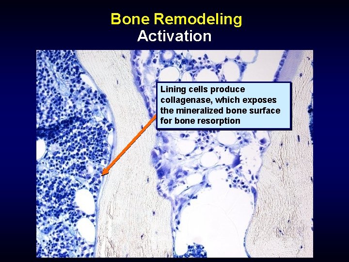 Bone Remodeling Activation Lining cells produce collagenase, which exposes the mineralized bone surface for