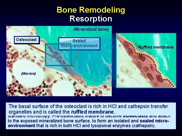 Bone Remodeling Resorption (Mineralized bone) Osteoclast Sealed micro-environment Ruffled membrane (Marrow) Cells derivedsurface from