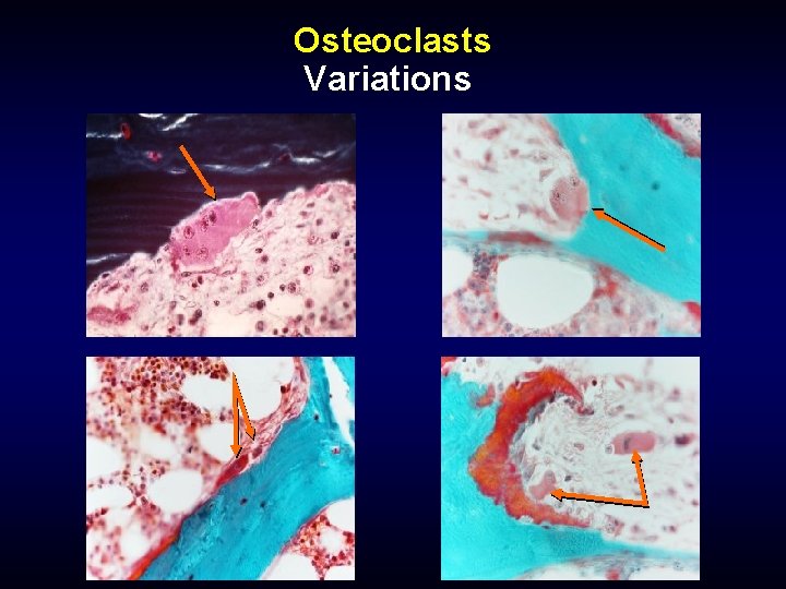 Osteoclasts Variations 