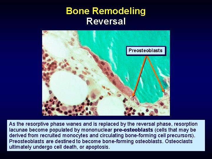 Bone Remodeling Reversal Preosteoblasts As the resorptive phase wanes and is replaced by the