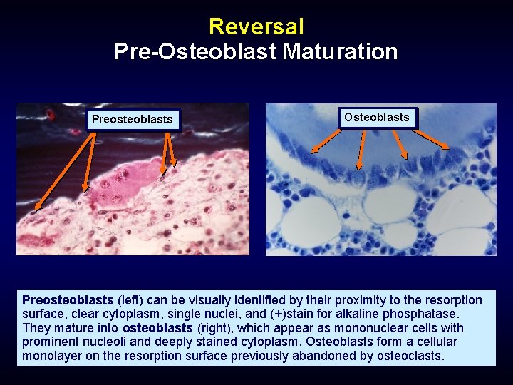 Reversal Pre-Osteoblast Maturation Preosteoblasts Osteoblasts Preosteoblasts (left) can be visually identified by their proximity