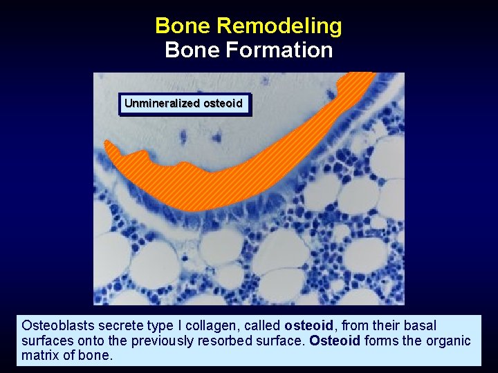 Bone Remodeling Bone Formation Unmineralized osteoid Osteoblasts secrete type I collagen, called osteoid, from