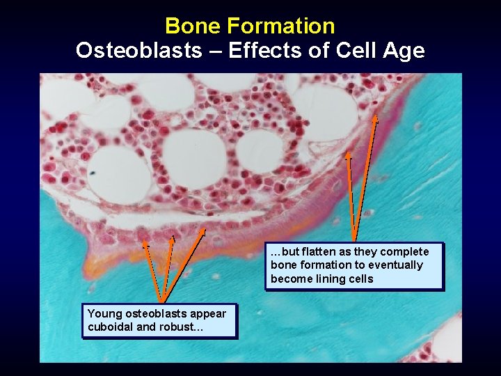 Bone Formation Osteoblasts – Effects of Cell Age …but flatten as they complete bone