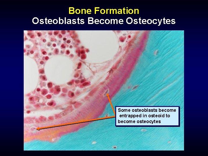 Bone Formation Osteoblasts Become Osteocytes Some osteoblasts become entrapped in osteoid to become osteocytes