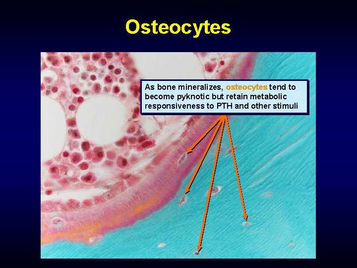 Osteocytes As bone mineralizes, osteocytes tend to become pyknotic but retain metabolic responsiveness to