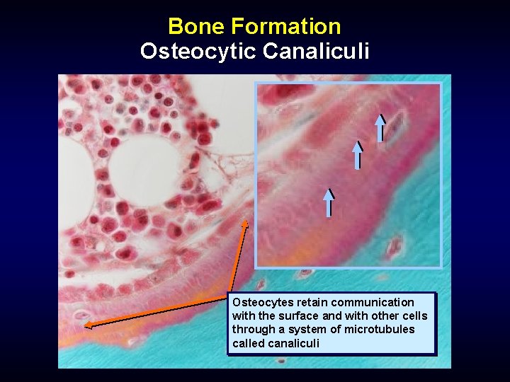 Bone Formation Osteocytic Canaliculi Osteocytes retain communication with the surface and with other cells