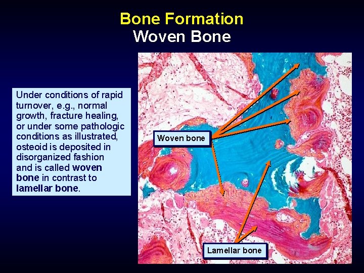 Bone Formation Woven Bone Under conditions of rapid turnover, e. g. , normal growth,