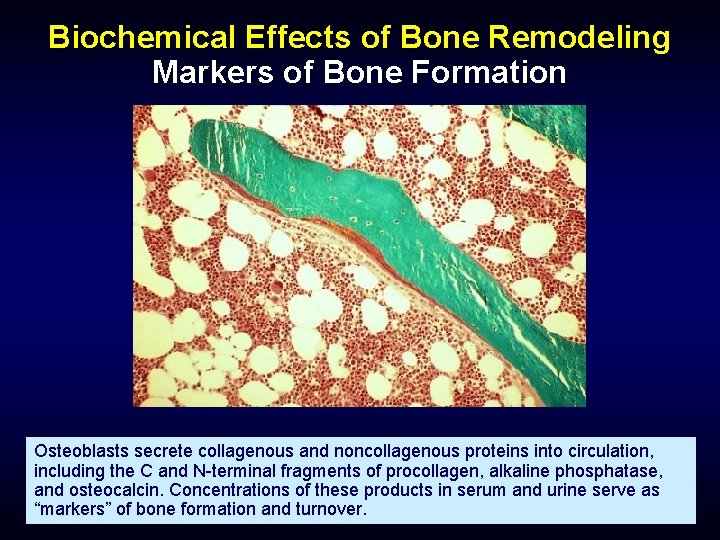 Biochemical Effects of Bone Remodeling Markers of Bone Formation Osteoblasts secrete collagenous and noncollagenous