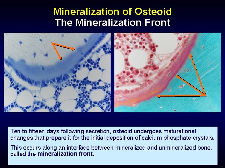 Mineralization of Osteoid The Mineralization Front Ten to fifteen days following secretion, osteoid undergoes