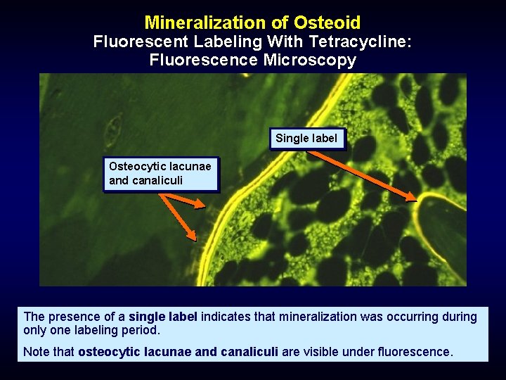 Mineralization of Osteoid Fluorescent Labeling With Tetracycline: Fluorescence Microscopy Single label Osteocytic lacunae and