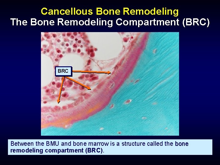 Cancellous Bone Remodeling The Bone Remodeling Compartment (BRC) BRC Between the BMU and bone