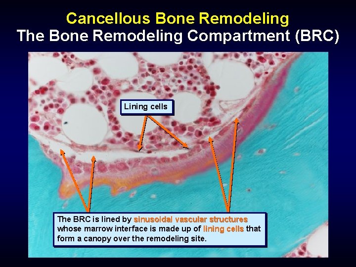 Cancellous Bone Remodeling The Bone Remodeling Compartment (BRC) Lining cells The BRC is lined