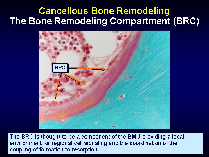 Cancellous Bone Remodeling The Bone Remodeling Compartment (BRC) BRC The BRC is thought to