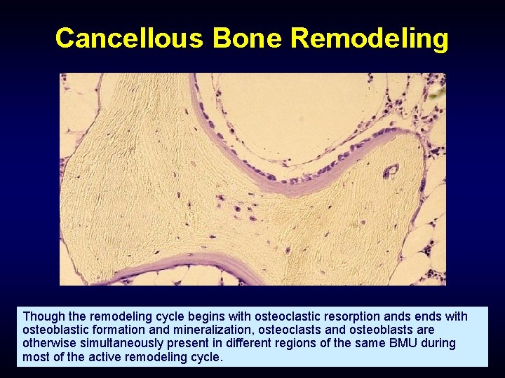 Cancellous Bone Remodeling Though the remodeling cycle begins with osteoclastic resorption ands ends with