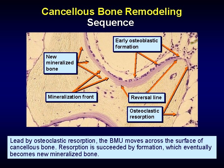 Cancellous Bone Remodeling Sequence Early osteoblastic formation New mineralized bone Mineralization front Reversal line